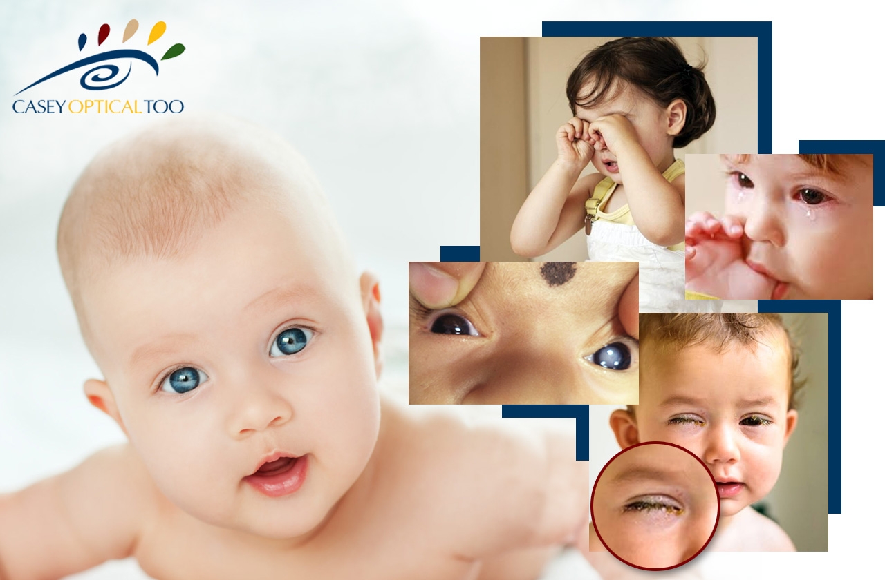 Signs of Vision Problems in Babies & Children