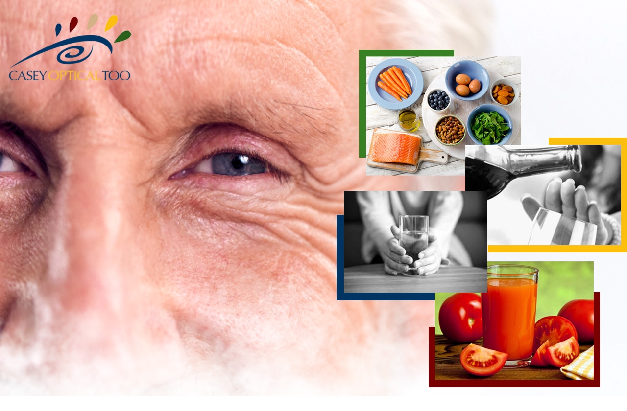 Cataract Prevention And Nutrition