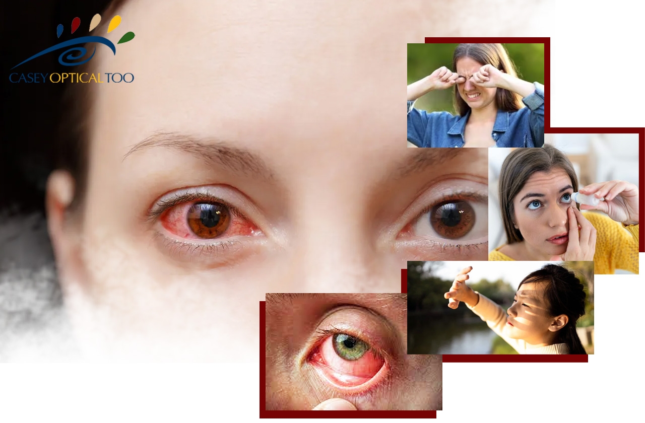 Conjunctivitis (pink eye) Symptoms, Causes, Treatment, Prevention