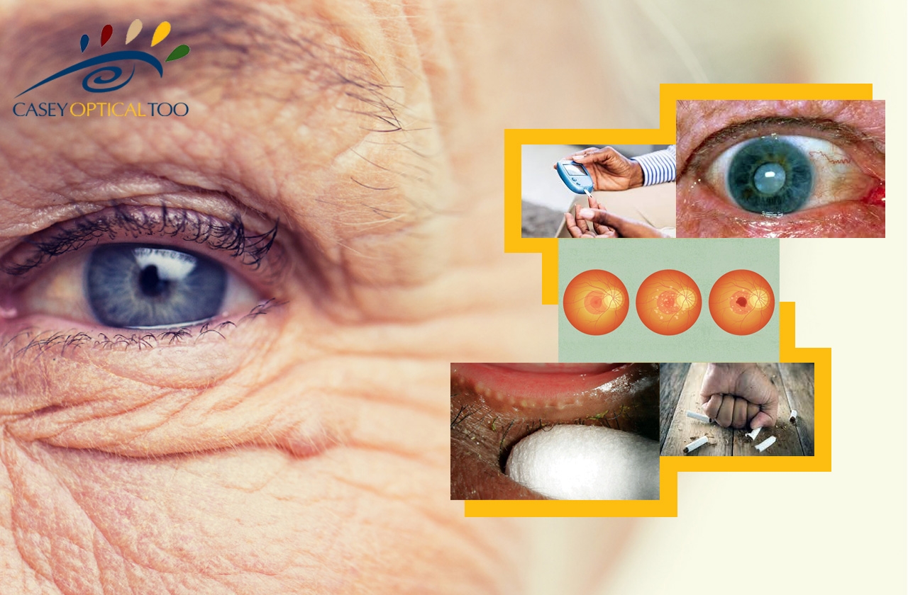 Age-Related Vision Changes: What To Expect
