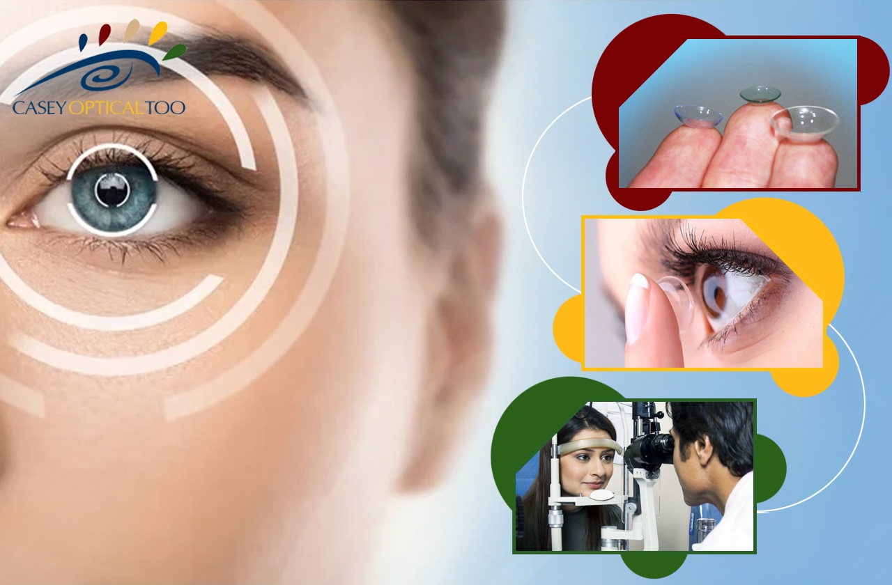 Contact Lenses For a Refractive Procedure