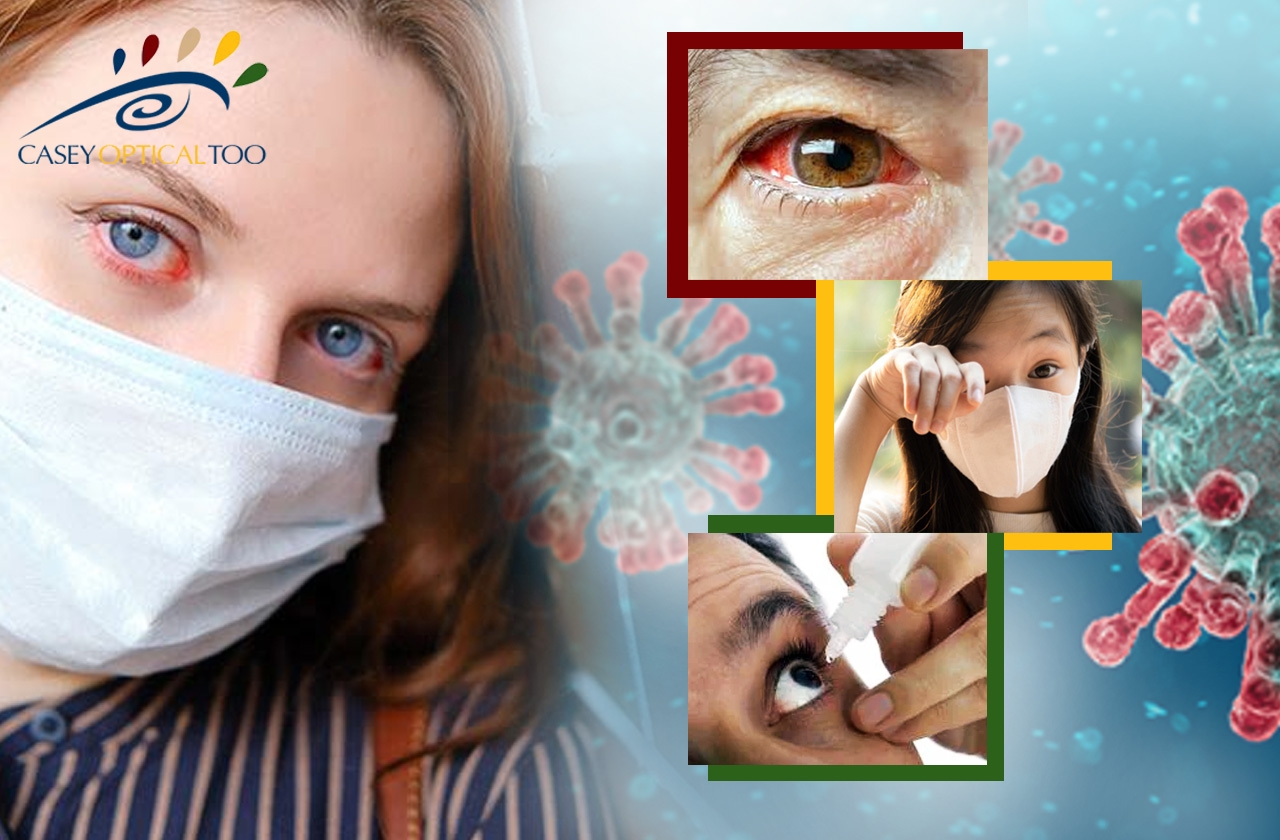 Is There a Link Between COVID-19 and Red Eyes?
