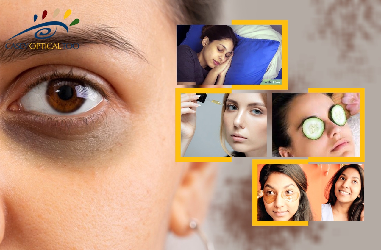 Discovering the Key to Getting Rid of Puffy Eyes and Dark Circles: A Complete Guide