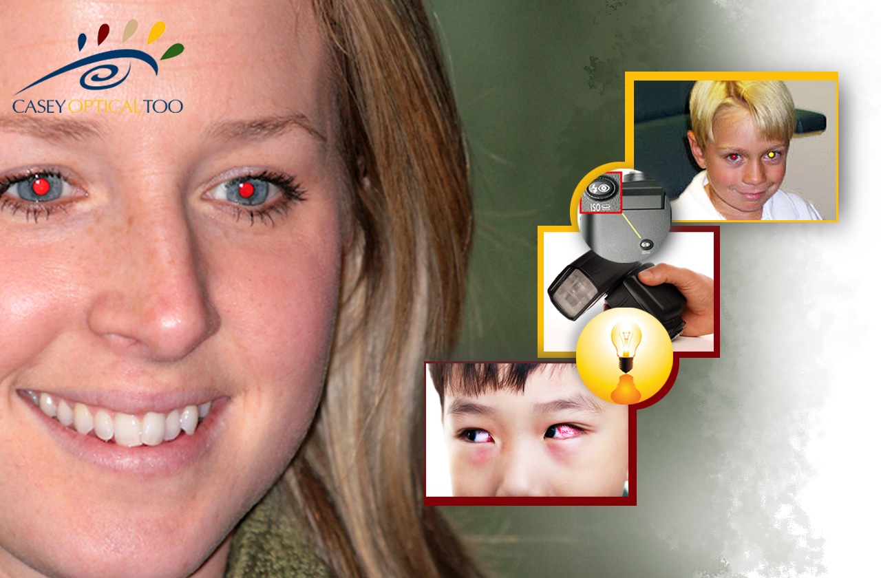 Capturing Moments: Understanding and Eliminating the Red-Eye Effect in Photographs