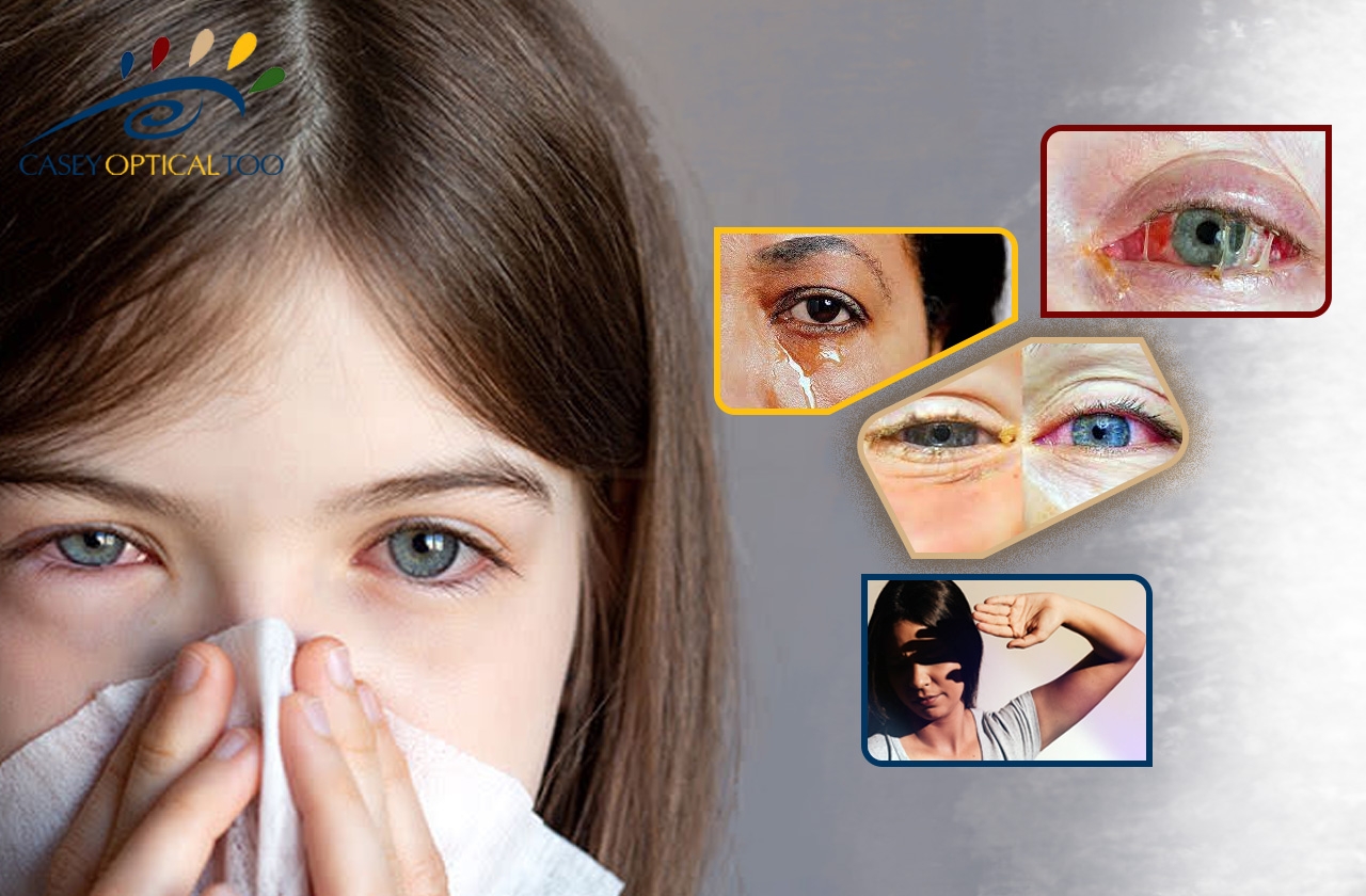  Understanding Eye Colds: Differentiating Between Conjunctivitis and Other Causes
